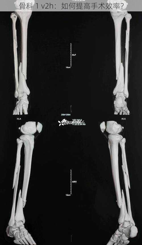 骨科 1 v2h：如何提高手术效率？