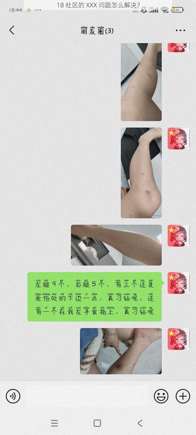 18 社区的 XXX 问题怎么解决？